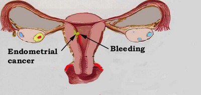 reasons for spotting after period