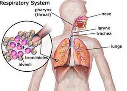 Hypersensitivity pneumonitis