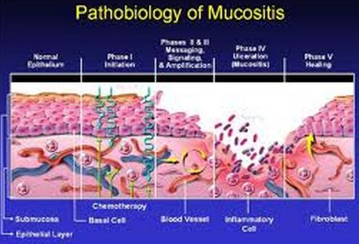 mucosistis pathobiology picture