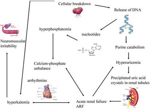 Tumor lysis syndrome pathophysiology, symptoms picture