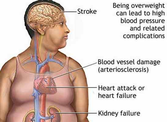 Excess body fat problems