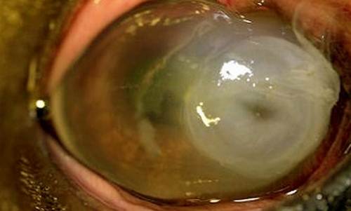 Corneal Ulcer pictures 
