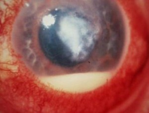 Corneal Ulcer - Treatment, Pictures, Symptoms, Causes in Dogs