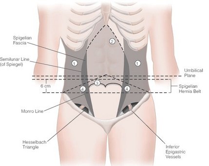 Spigelian Hernia anatomy and location