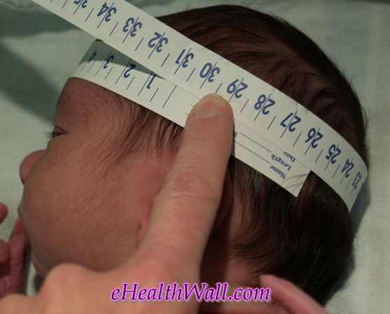 head circumferenec measurement for microcephaly diagnosis