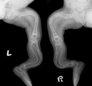 deformed long bone x ray