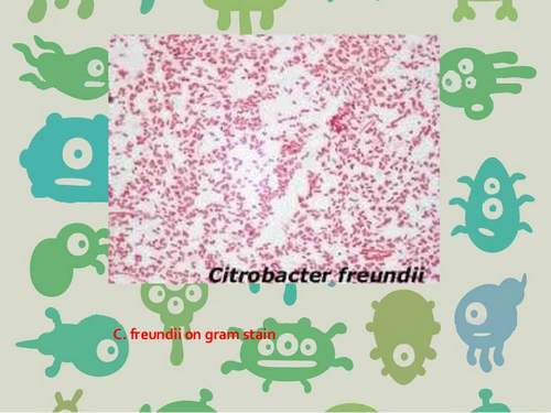 An imaging study of Citrobacter Freundii.photo