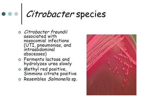 How C. freundii organism looks like.image